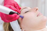 Microneedling / Vitamin / Narben,-Akne Behandlung